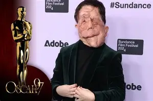 Adam Pearson actor known for A Different Man trending after Oscars season coverage