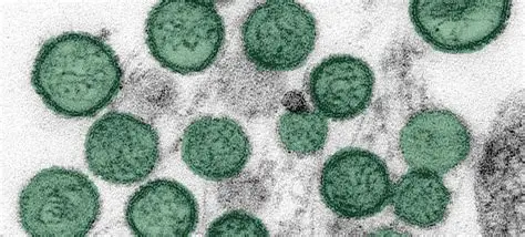 CDC epidemiologists responding to hantavirus cruise ship outbreak 2026