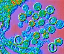 Hantavirus by state public health monitoring update